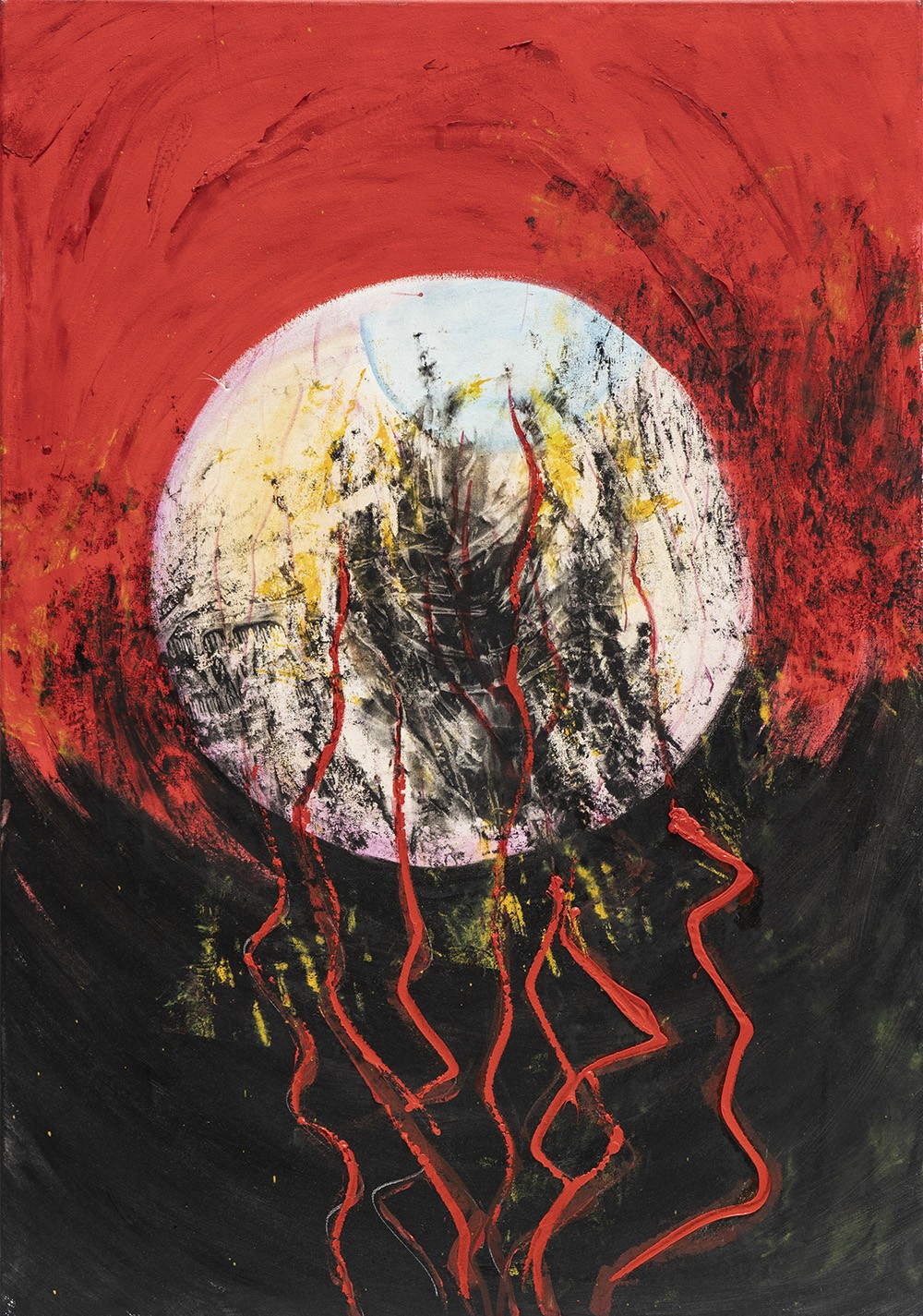 Maculopatía degenerativa